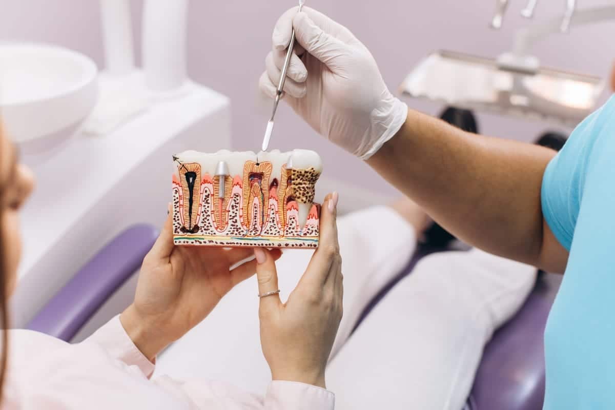 Root Canal Treatment in Towson
