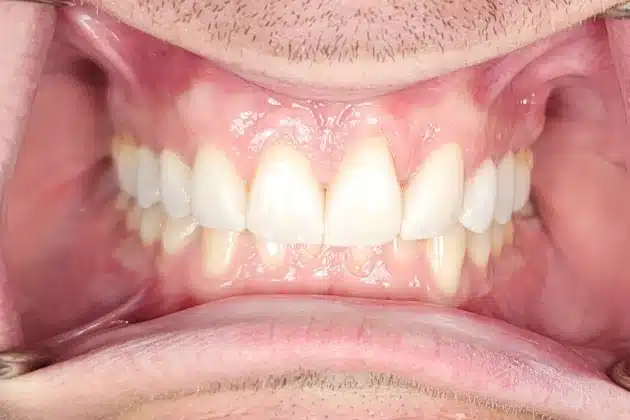 cosmetic dentistry after
